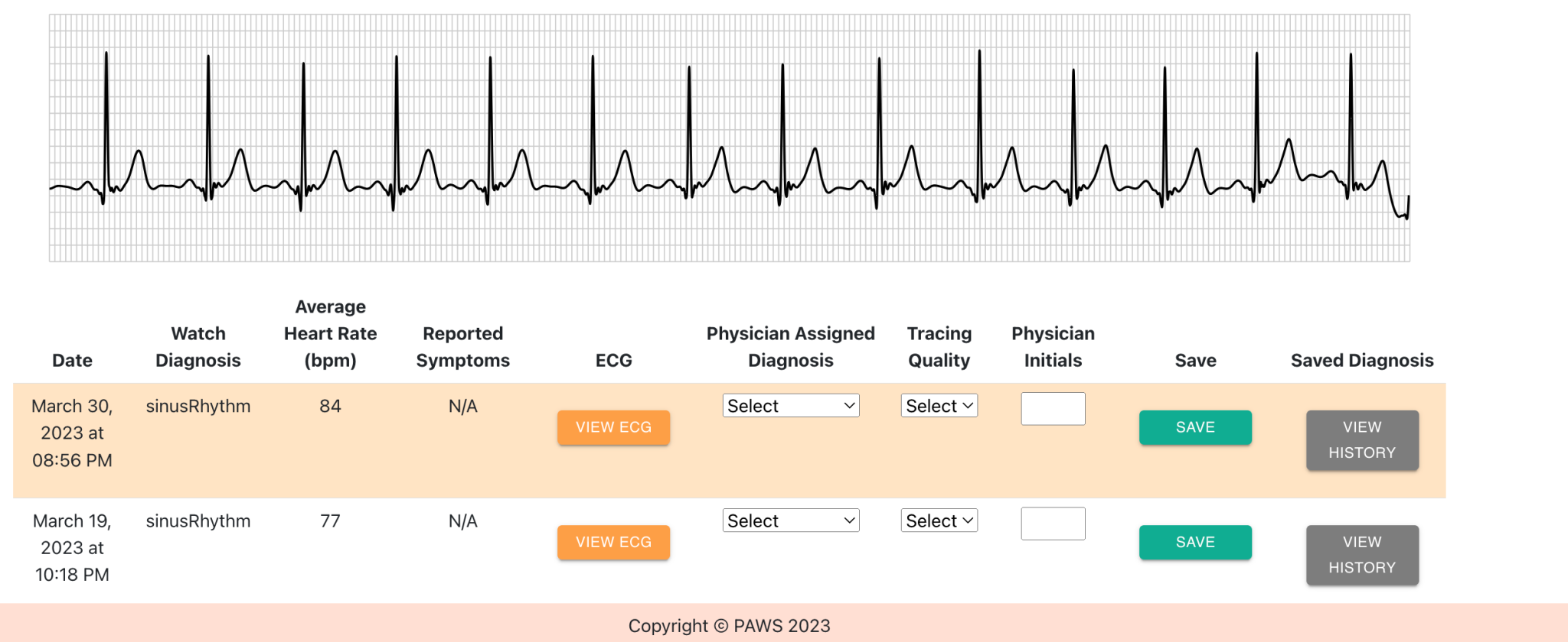 web app screen showing ECG analysis